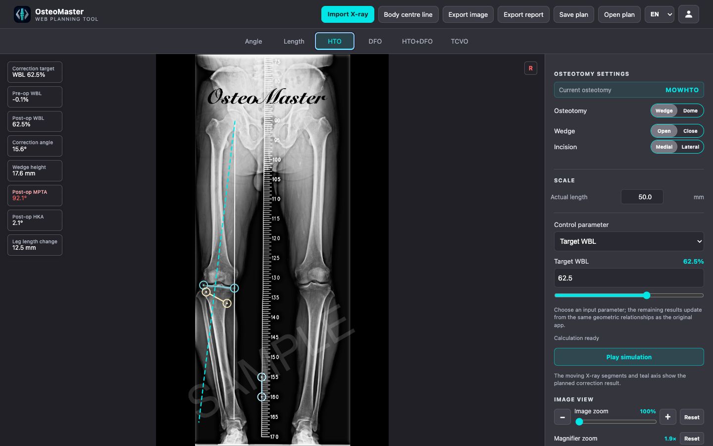 Real OsteoMaster desktop browser HTO planning and simulation workspace